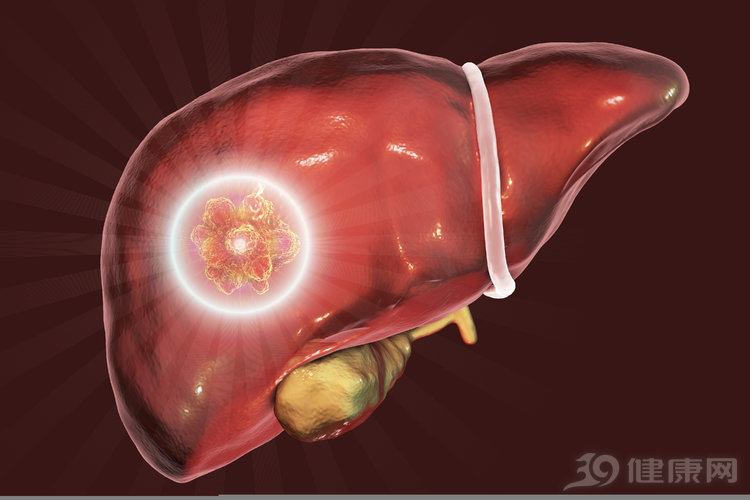 得了肝癌不用慌这个方子有奇效,得了肝癌怎么调整心态
