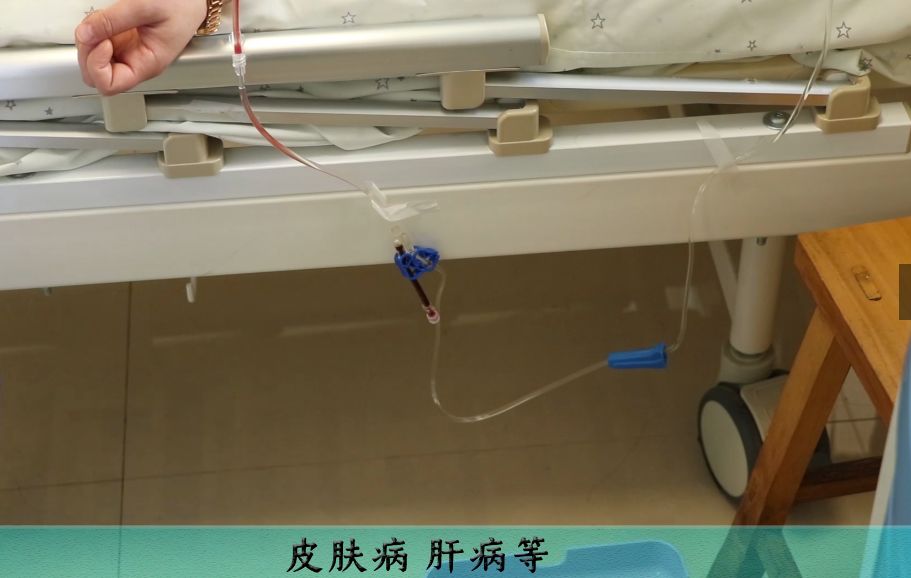 净血排毒方法,三氧净血疗法