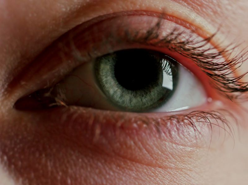 怎么去除眼睛红血丝,眼睛红了有血丝痒