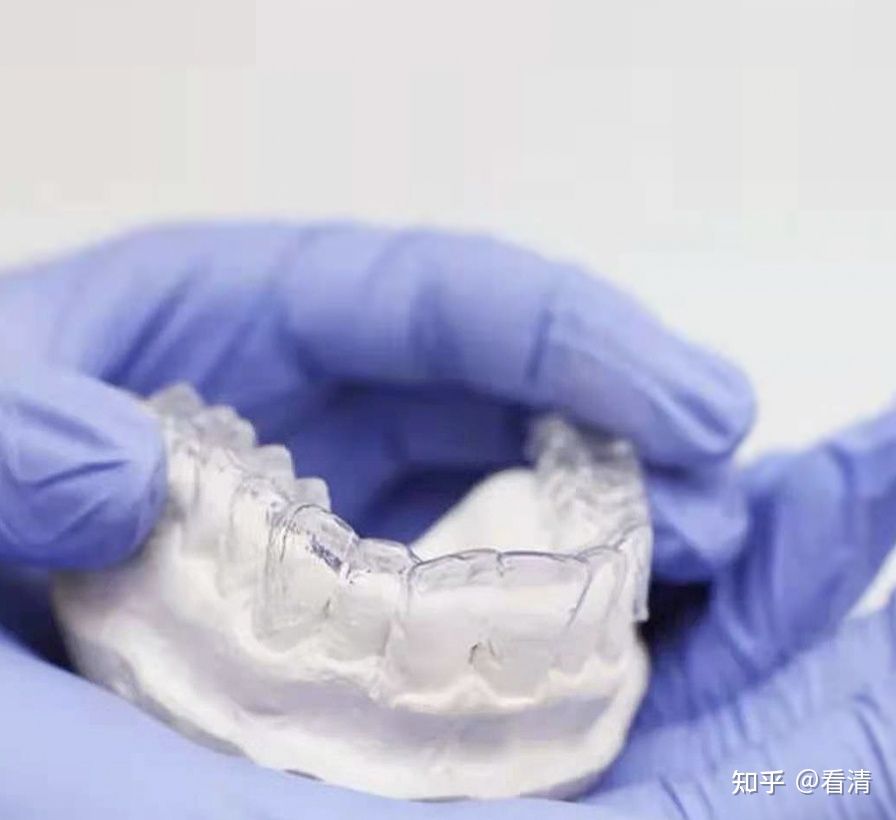 戴牙套是什么感觉,补牙后戴牙套的危害