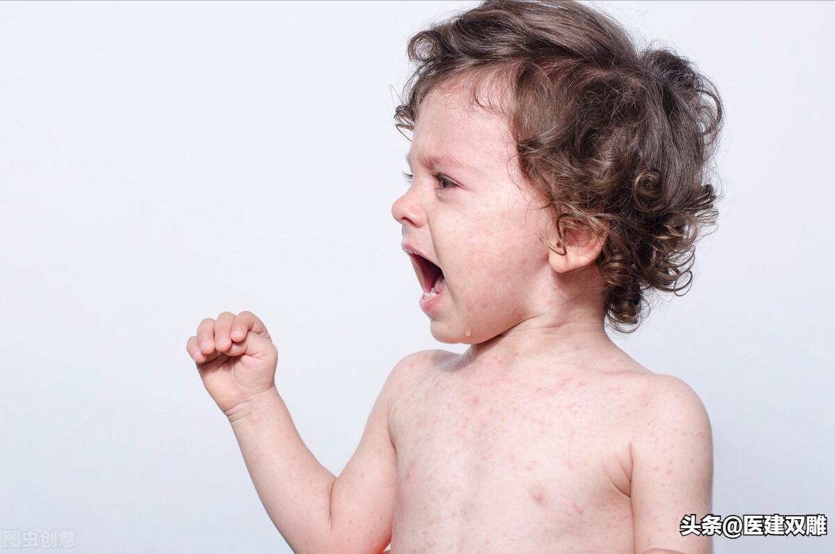 复方炉甘石抑菌洗剂都有什么妙用,炉甘石洗剂婴儿妙用