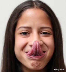 舌系带短与正常舌系带图片对比,舌系带短介绍