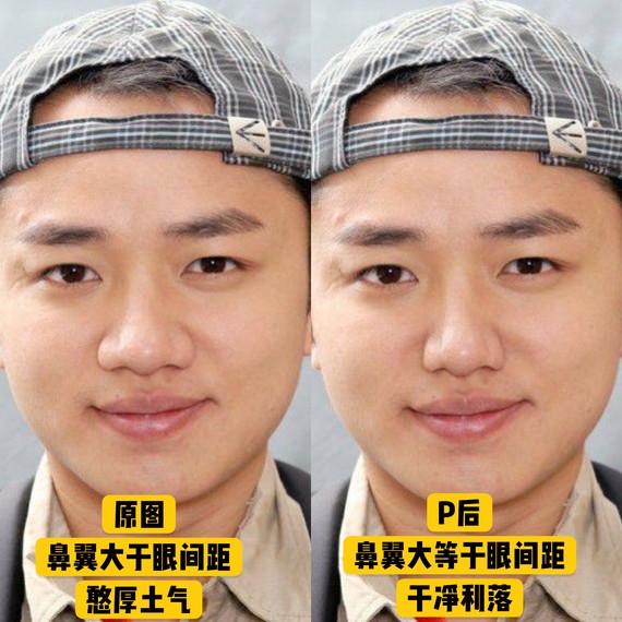 好看的鼻子类型驼峰鼻,好看的鼻型有哪几种