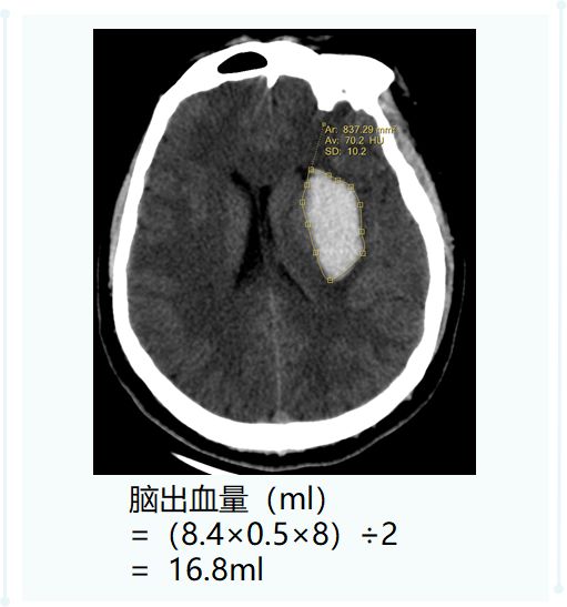 ct后处理重建技术,ct后处理技巧