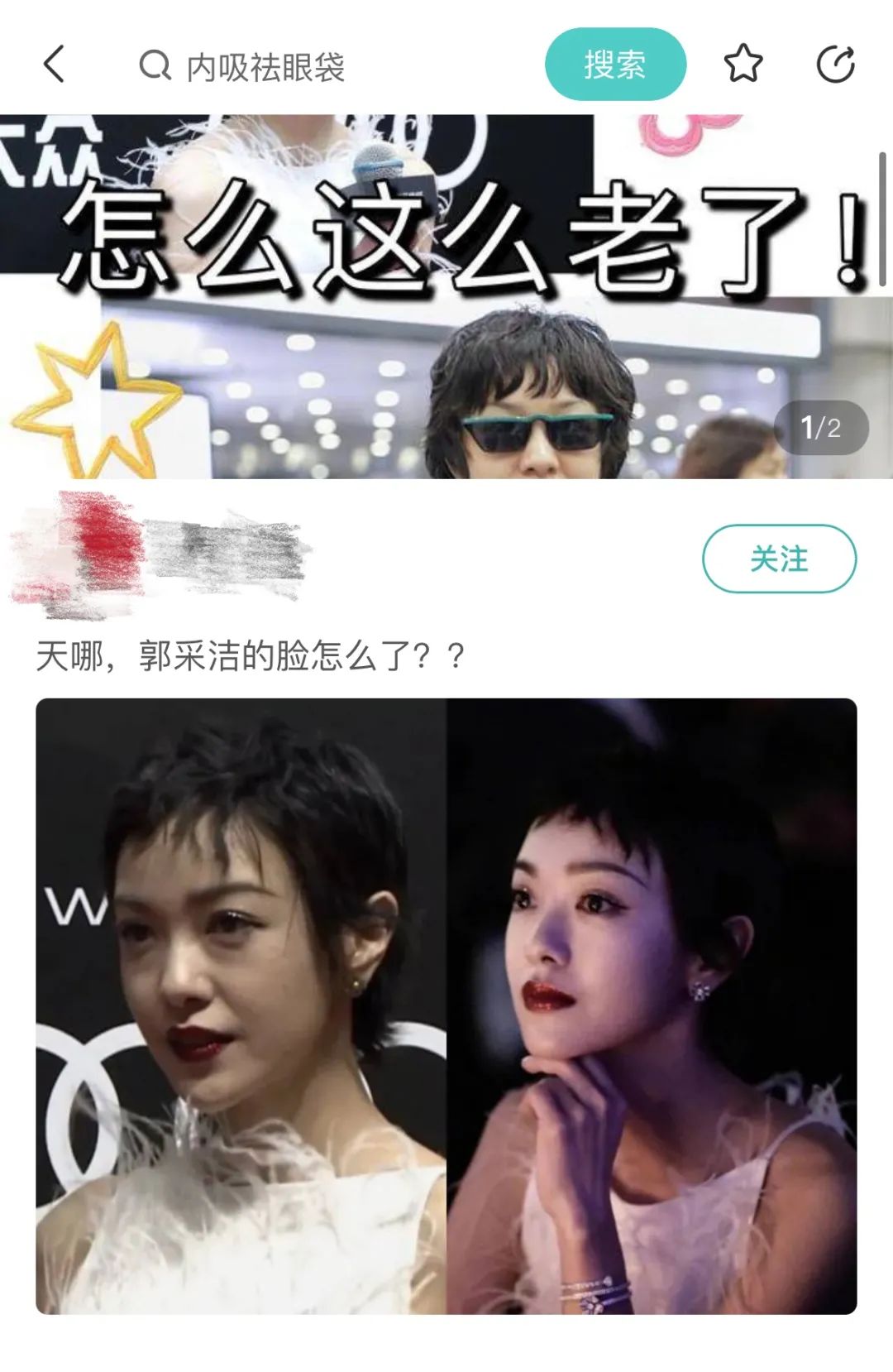 “漫画腿”、“精灵耳”的整容风，为什么越来越失控？
