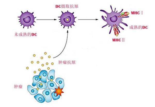 树状突细胞肉瘤治疗方案,树突状细胞肿瘤是什么