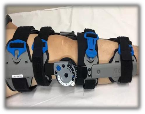 运动损伤的治疗与康复知识点,运动损伤的诊治