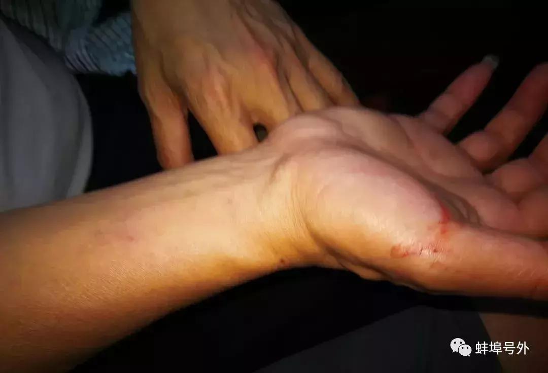 蚌埠市公安局抓捕电信诈骗,蚌埠市公安局抓捕行动