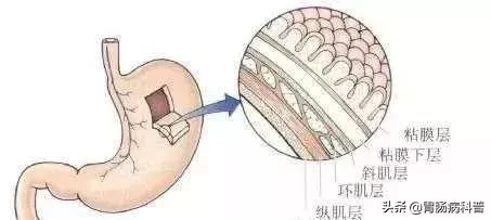 糜烂性胃炎医生说一切正常,糜烂性胃炎的问诊