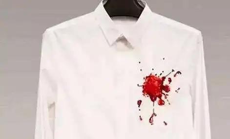 白衣服发黄了怎么办用什么方法,白衣服有黄渍要怎样去除