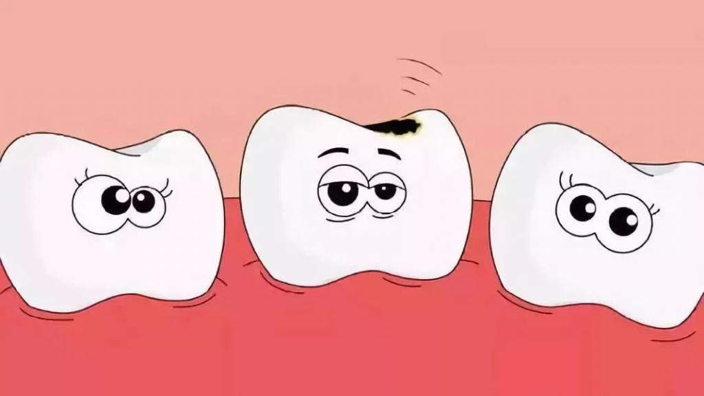 孩子牙齿有黑点是怎么回事,孩子牙齿有黑点怎么处理