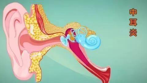 中耳炎里面长了个瘤子,中耳炎长瘤子