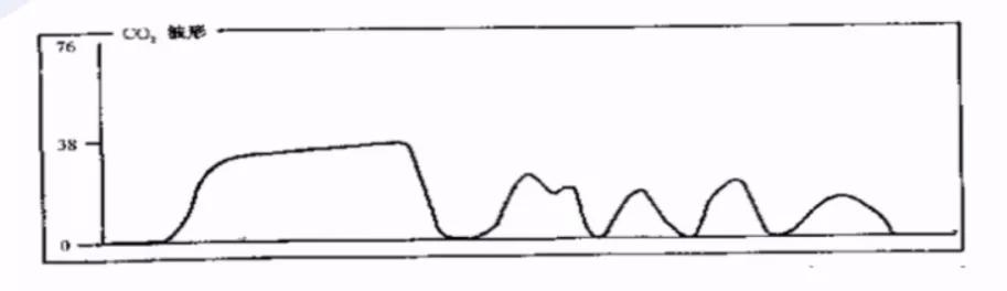 李娟教授：呼气末二氧化碳分压监测的临床应用