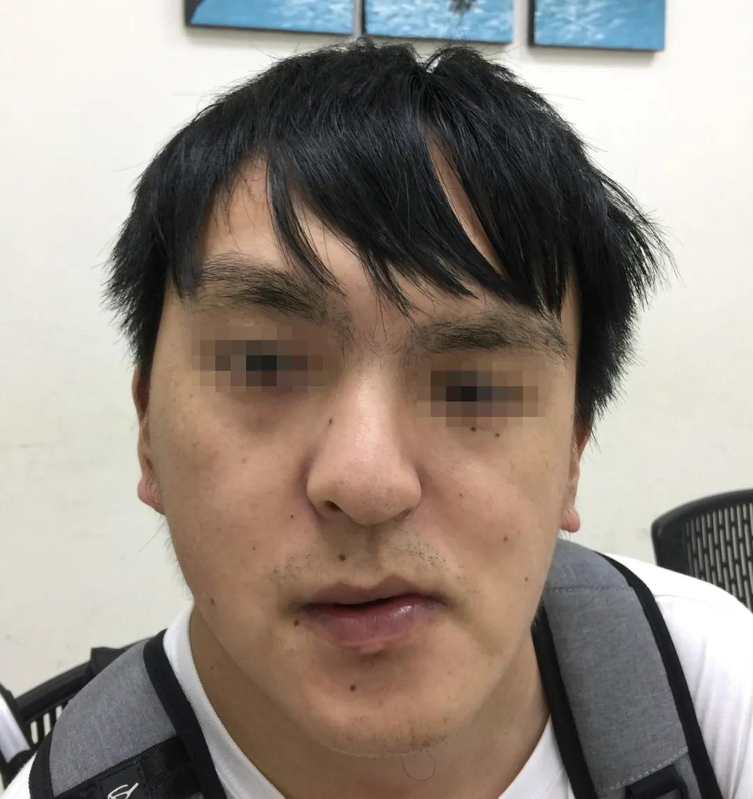 歪脸是什么原因造成的,歪脸怎么治