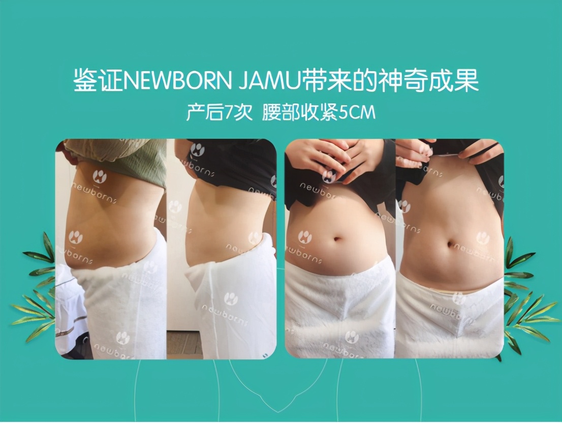 产后骨盆修复了还需要做腹直肌吗,生完孩子一定要做腹直肌修复吗