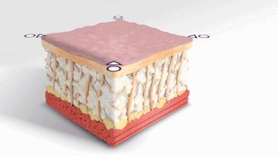 超声炮做了之后脸部有凹陷怎么办,超声炮刚做完脸部凹陷是怎么回事
