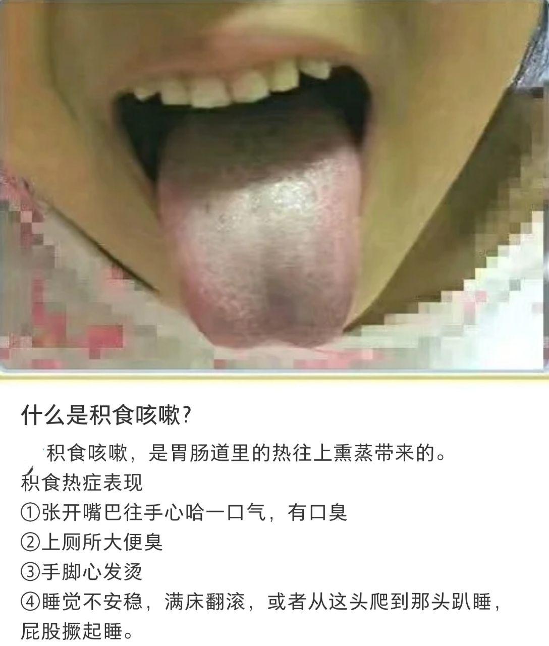 气温下降咳嗽,气温下降就咳嗽喘不过气