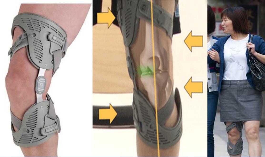 膝关节骨性关节炎症状及治疗,膝关节骨性关节炎诊疗指南下载