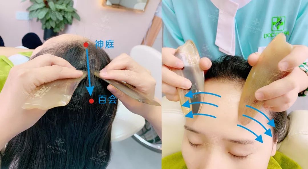 专家推荐治疗脱发白发食疗药酒,中医调理白发脱发养发