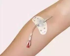 化疗后的居家护理，有这7点要注意