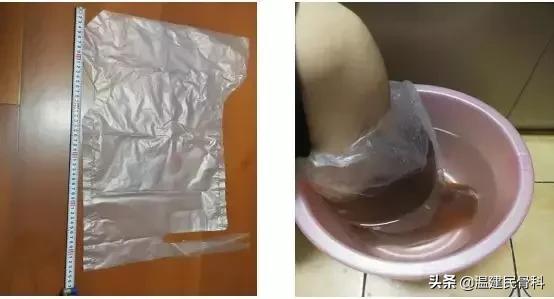 拇外翻平时走路需要注意哪些点,如何缓解拇外翻脚的痛