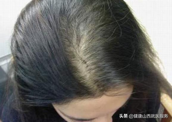 白发多跟什么有关,年龄18岁长了好多白发怎么回事