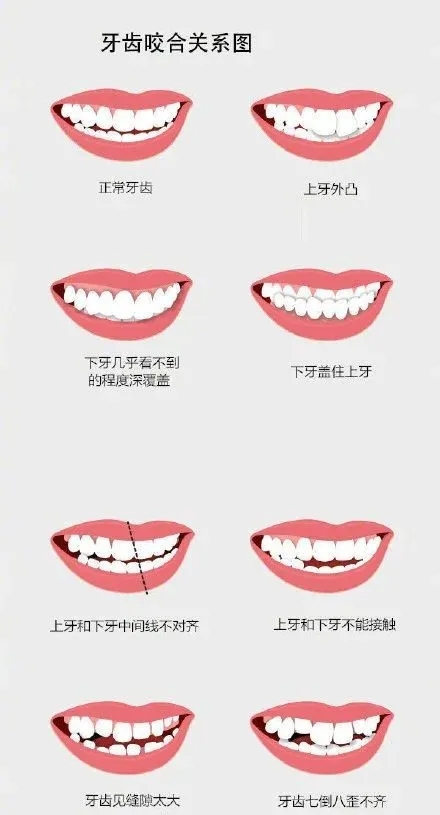 “龅牙”是深覆颌还是深覆盖，两者如何区分？还能不能治疗？