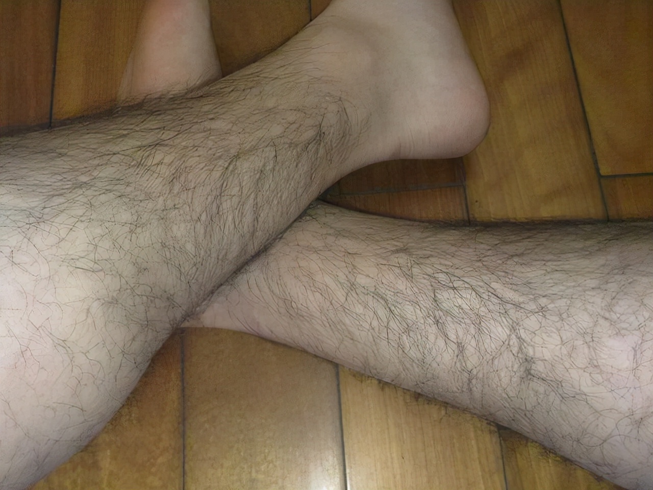 男性腿毛稀少是肾不好吗,男性腿毛少代表什么