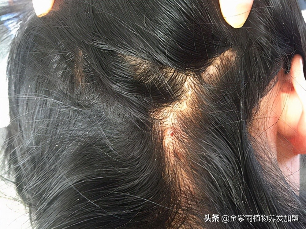 金紫雨养发加盟经营模式,加盟金紫雨植物养发靠谱吗