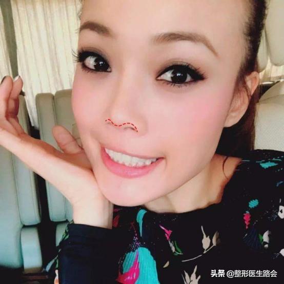 听说好看的鼻子都有一只海鸥在飞，你的海鸥飞得怎么样？