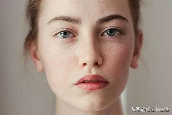 刷酸为什么避开脸颊,刷酸会脸垮吗