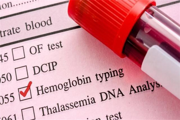 尿酸800肌酐110到底严重不严重,尿酸高的人千万注意了