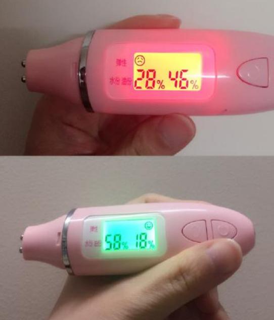 19岁女生打“美容针”脸肿得像包子，到医院检查，医生怒斥：无知