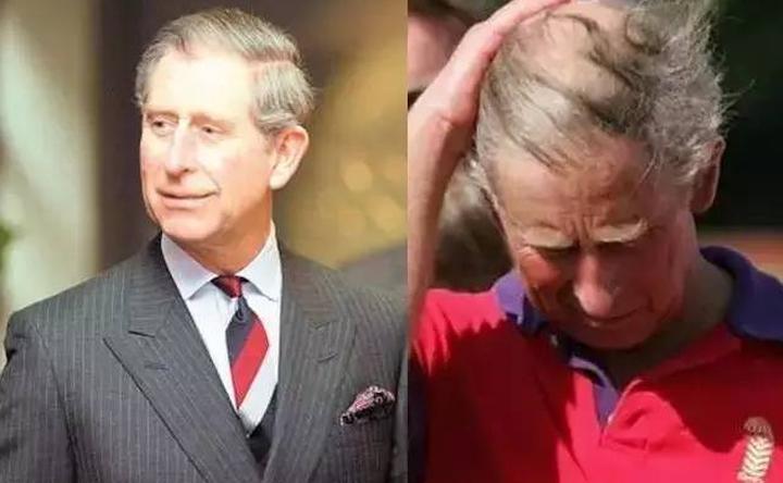 贝克汉姆秃了,贝克汉姆的头发秃了上热搜