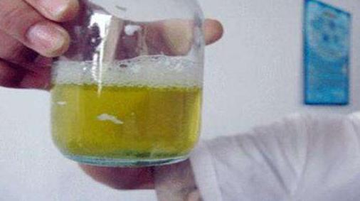 猪尿石症特征,猪泡沫尿是什么病