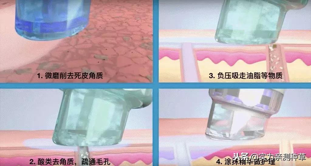 揭秘小气泡真的能去角质吗,小气泡洗脸真的有用吗