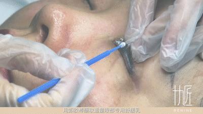 眼睛戴美瞳有血丝红肿怎么办,眼睛戴了美瞳红肿一碰就痛