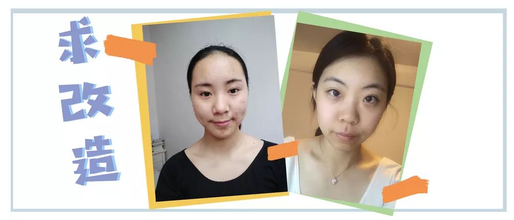 求改善痘痘真实办法,想改变脸上痘痘
