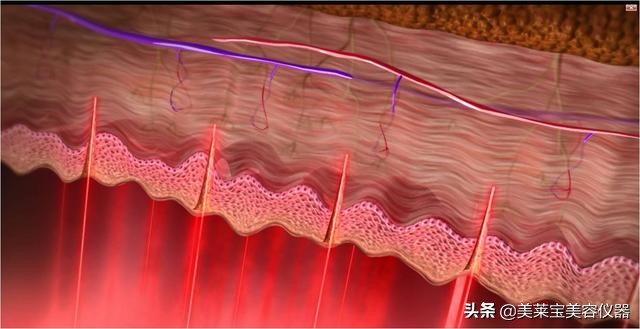 全新的美容修复仪器,多肽修护美容仪