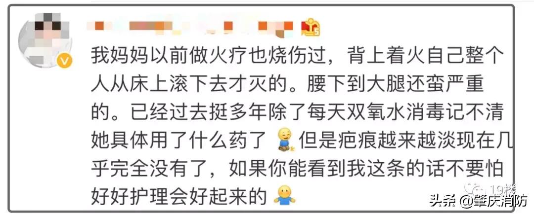 女子拔火罐被烧伤后续,明星拔火罐烧伤事件