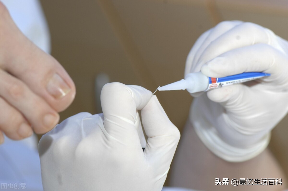 胶粘剂行业现状分析,胶粘剂行业现状及前景