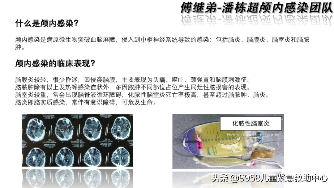 颅内感染康复治疗知识,小儿颅内感染的健康宣教