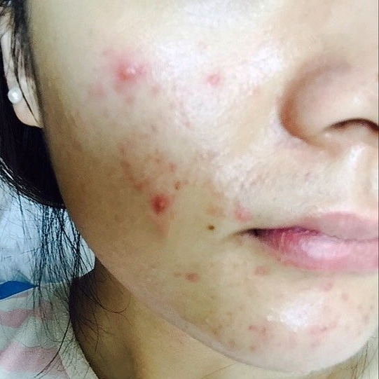 美白抗衰小知识,美白抗衰三件事