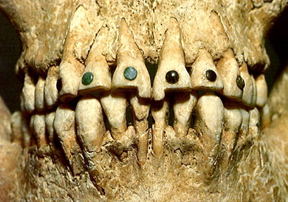 死老鼠治牙疼,尿液当漱口水,这些古人治牙全凭想象力