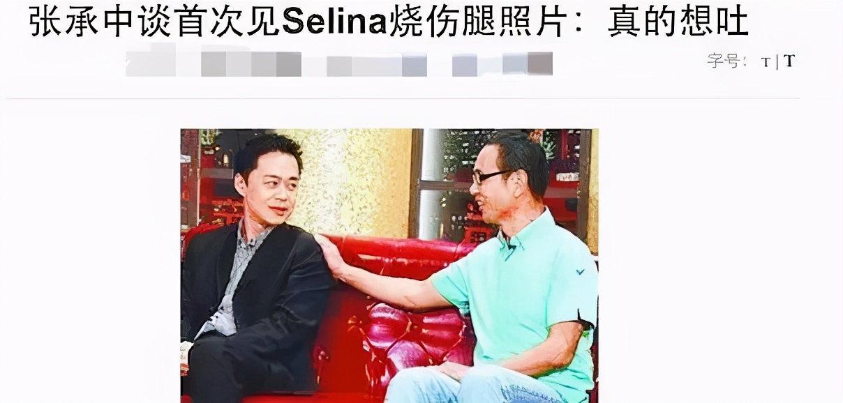 任家萱讲述烧伤经历,任家萱烧伤完整赔偿