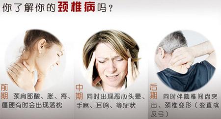 神经根型颈椎病保守治疗效果好吗,神经根型颈椎病保守治疗效果