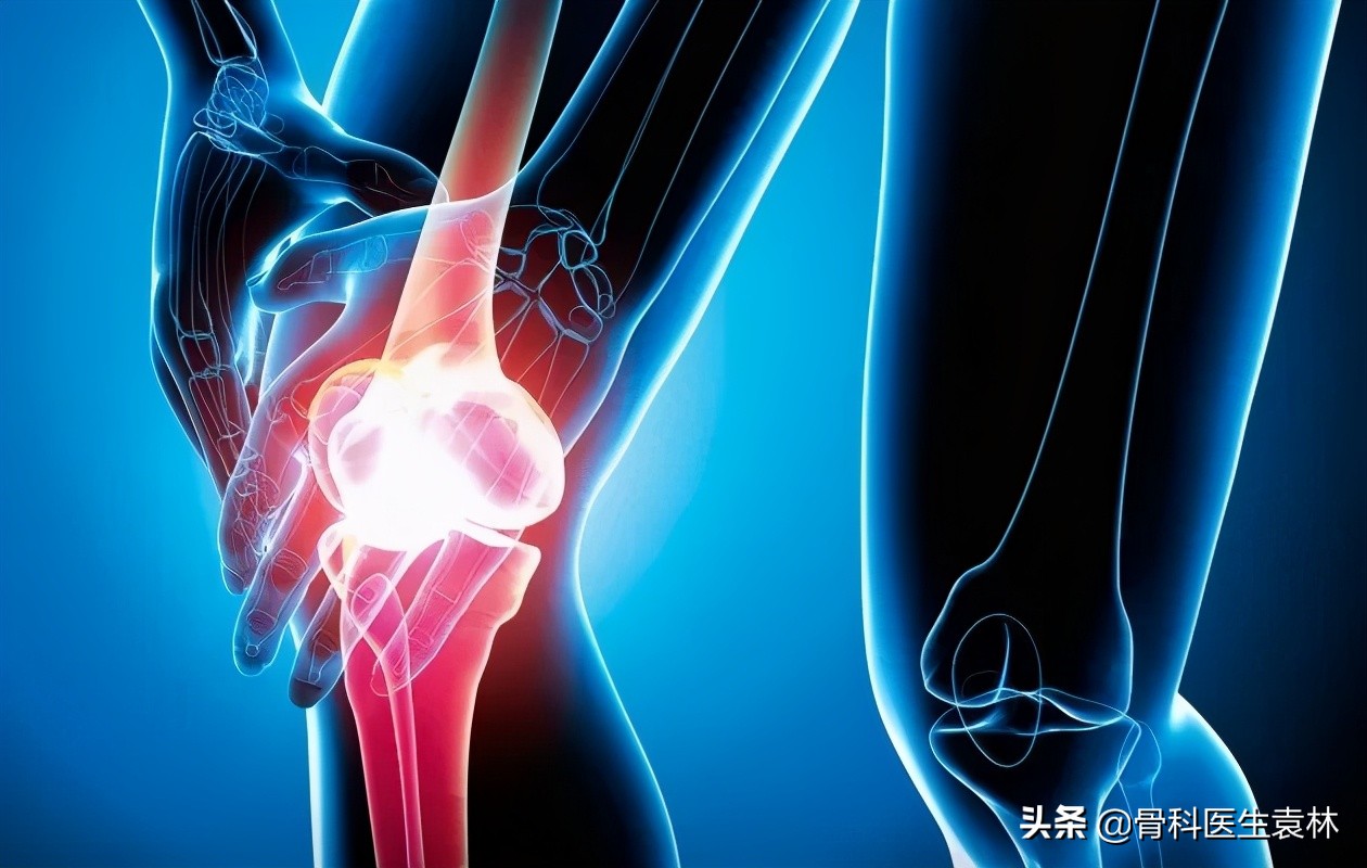 走路突然腿软膝盖一弯是怎么回事,走路膝盖突然猛的一软和有积液