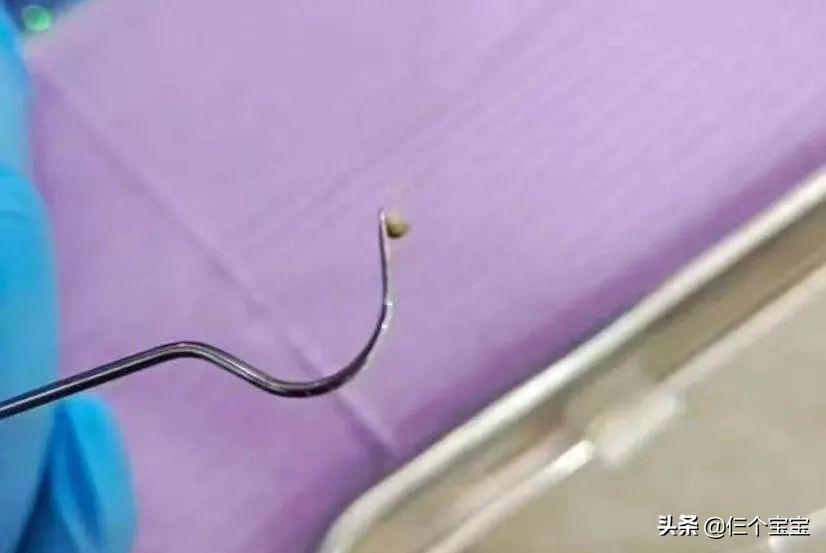 草莓籽在嘴里发了芽？刷牙少了这一步，你真的只是刷了个寂寞