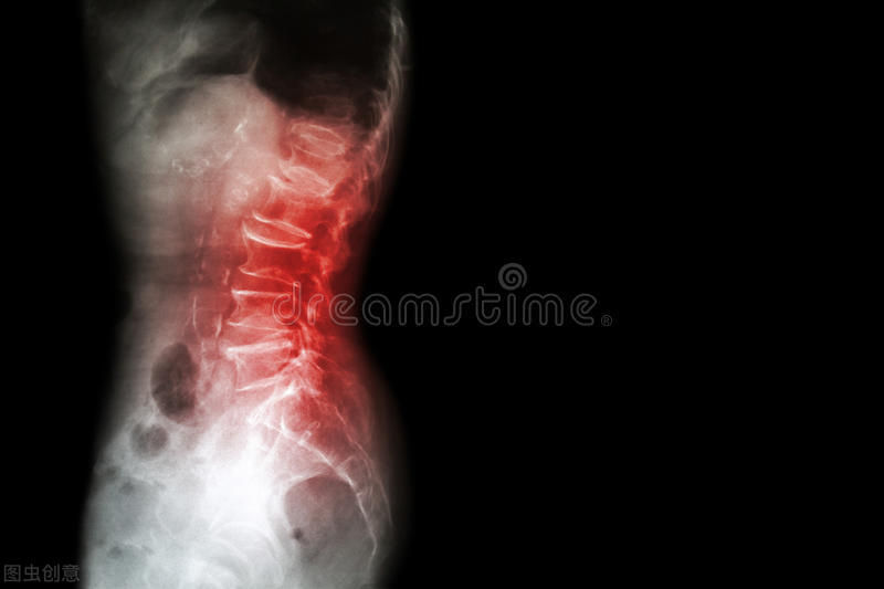 治崩漏什么时候吃止血药最好,崩漏治得好吗