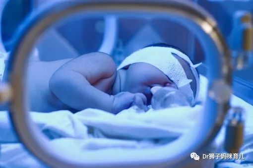 家里有肝病小孩黄疸高,有黄疸的宝宝应该怎么照顾